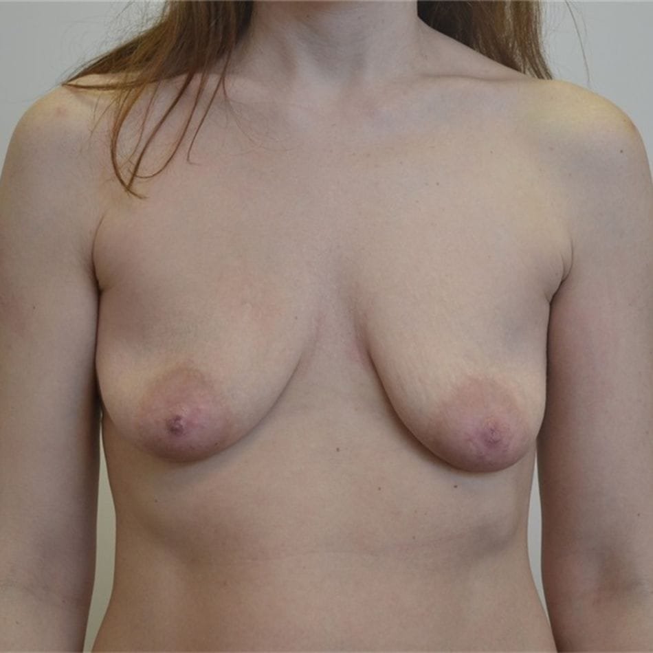 Öncesi-Sonrası 28 Before