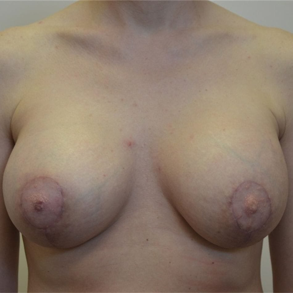 Öncesi-Sonrası 30 After