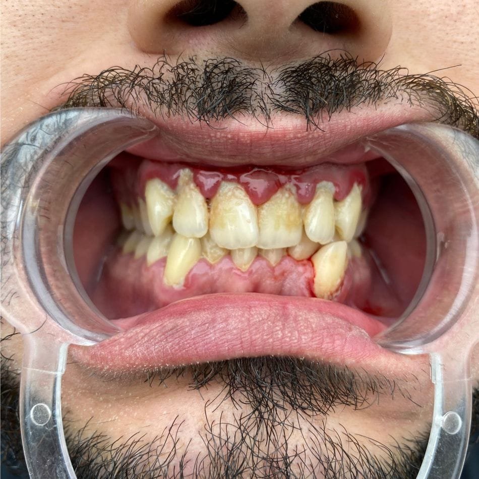 Öncesi-Sonrası 133 Before