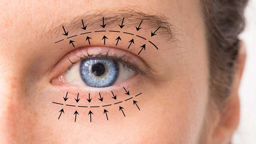 alfa heal eyelid aesthetics