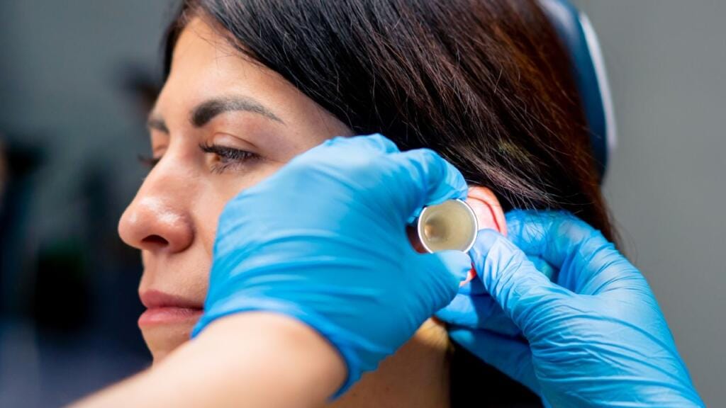 alfa heal otoplasti thumbnail